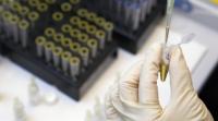 Американские врачи объявили, что полностью вылечили двухлетнюю девочку от ВИЧ-инфекции